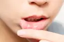 Skuteczne sposoby na smarowanie nadżerek w jamie ustnej, które przynoszą ulgę