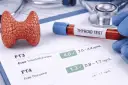 Wyniki badań tarczycy: FT3 4.0, FT4 1.3. Model tarczycy i probówka z krwią do testu.