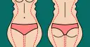 Ilustracja pokazuje sylwetki z zaznaczonymi liniami, sugerującymi zabieg. Warto znać liposukcja kawitacyjna przeciwwskazania.