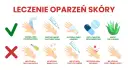 Co na oparzenia dla dziecka: chłodna woda, maść z antybiotykiem, zimny kompres, tabletki przeciwbólowe, sok z aloesu. Unikaj masła, jajka, pasty do zębów, lodu.