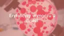 Badanie moczu: ogólne czy posiew? Zrozum różnice i diagnozę