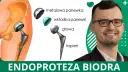 Jakie endoprotezy stawu biodrowego refunduje NFZ i ile kosztują?