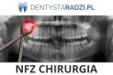 Gdzie wyrwać zęba na NFZ? Znajdź darmowe usunięcie zęba bez bólu