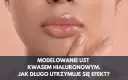 Kwas hialuronowy usta jak długo efekt - co musisz wiedzieć?