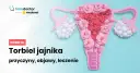 Jakie leki hormonalne na torbiel jajnika mogą skutecznie pomóc?