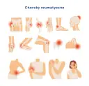 Objawy bólu reumatycznego: rozpoznaj wczesne sygnały i działaj!