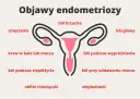 Objawy endometriozy: ból brzucha, zmęczenie, krew w kale/moczu, ból podczas współżycia, obfite miesiączki, ból głowy, ból podczas wypróżniania, ból przy oddawaniu moczu, niepłodność.