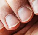Pofalowane paznokcie: przyczyny, leczenie i domowe sposoby