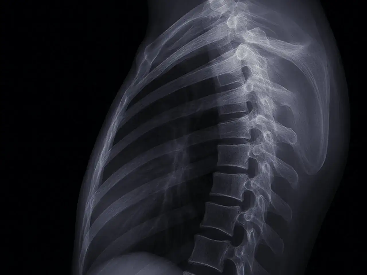 Kręgosłup piersiowy - objawy neurologiczne. Kiedy to coś poważnego?