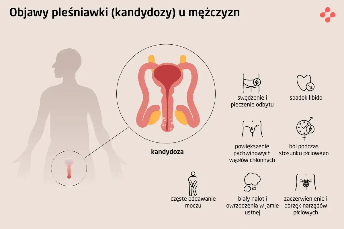 Kandydoza - objawy, leczenie i kiedy iść do lekarza