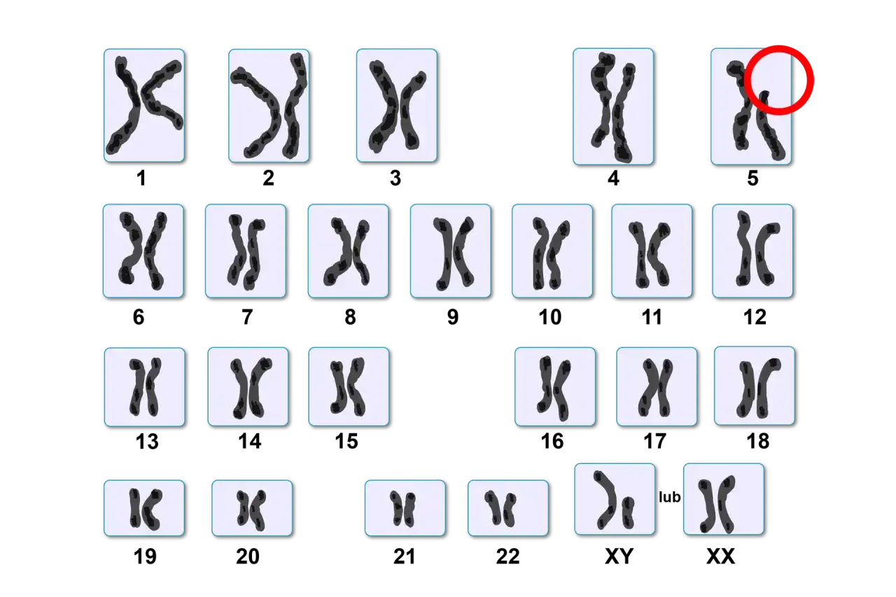 Ile chromosomów ma człowiek? 46, wyjątki i znaczenie kariotypu