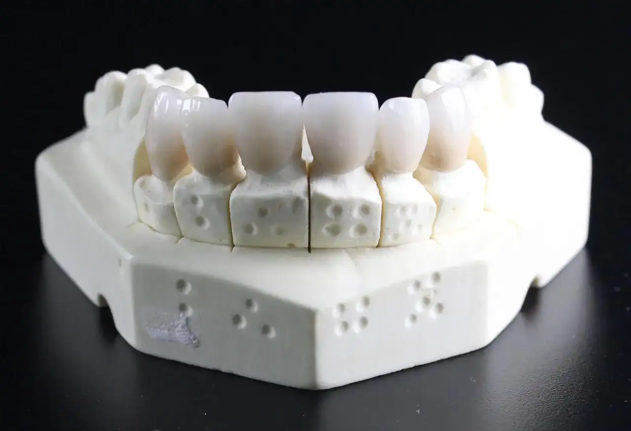 Brak zęba - jak zamaskować i kiedy do dentysty?