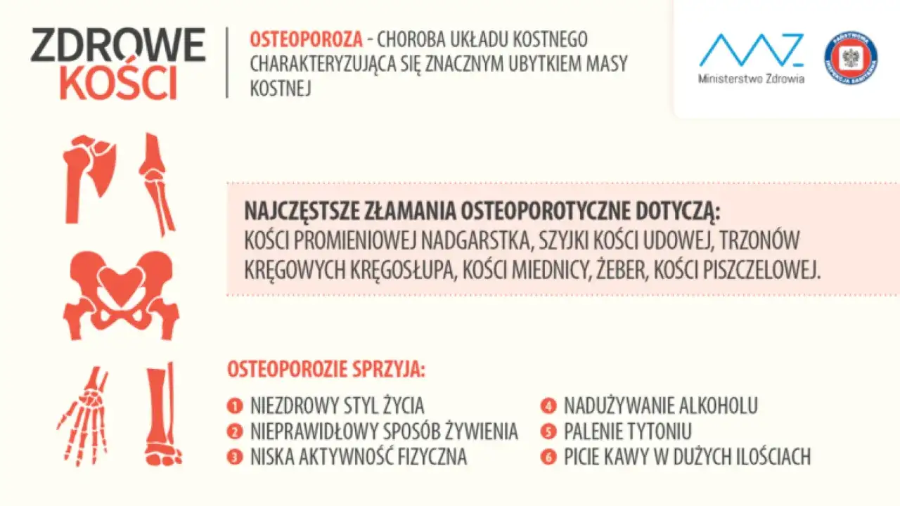 Leczenie osteoporozy - jak zmniejszyć ryzyko złamań?