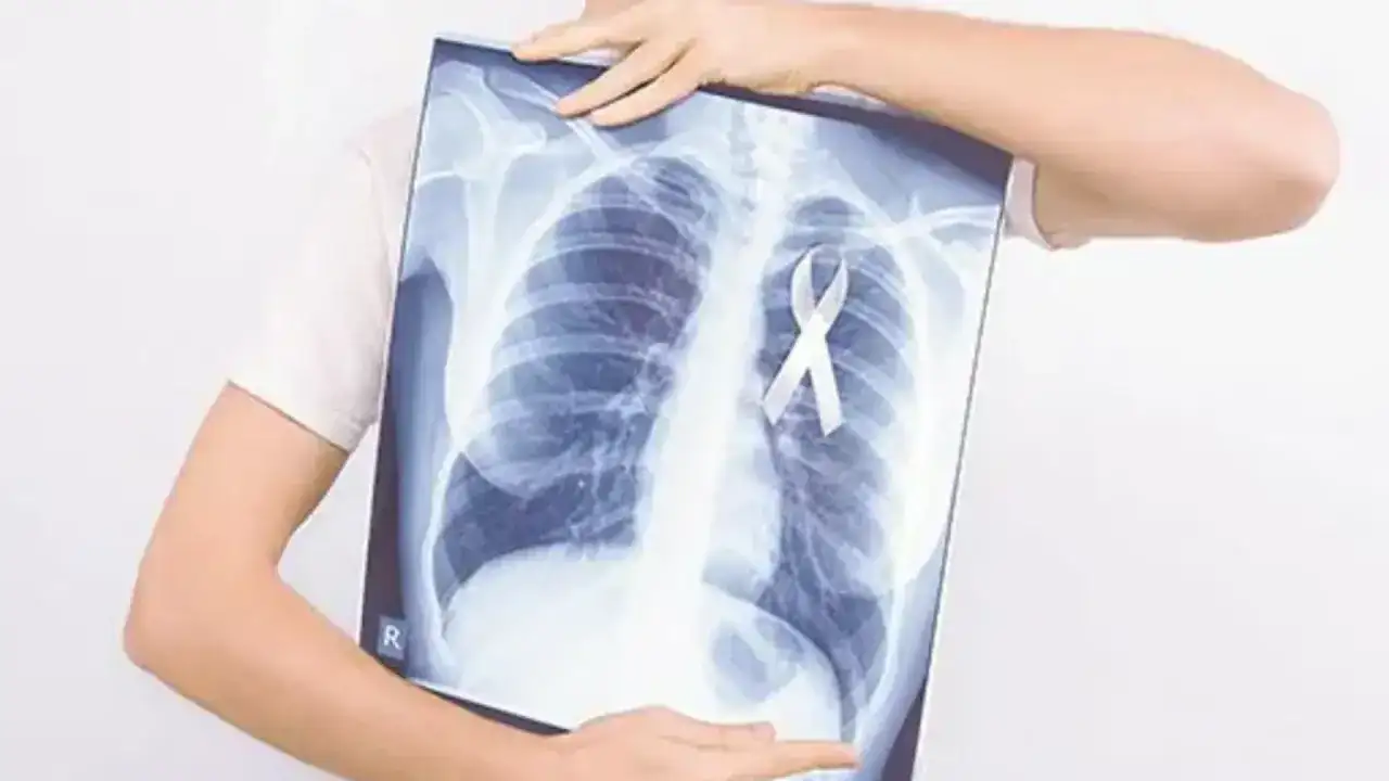 Pembrolizumab - jak działa i kiedy pomaga w leczeniu nowotworów?