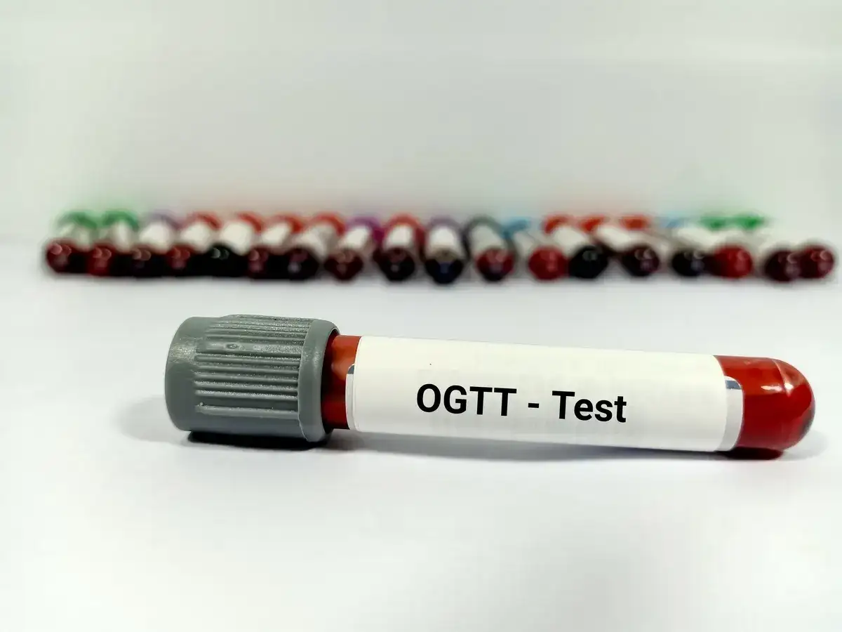 Test obciążenia glukozą - Wyniki i interpretacja (ciąża i nie)