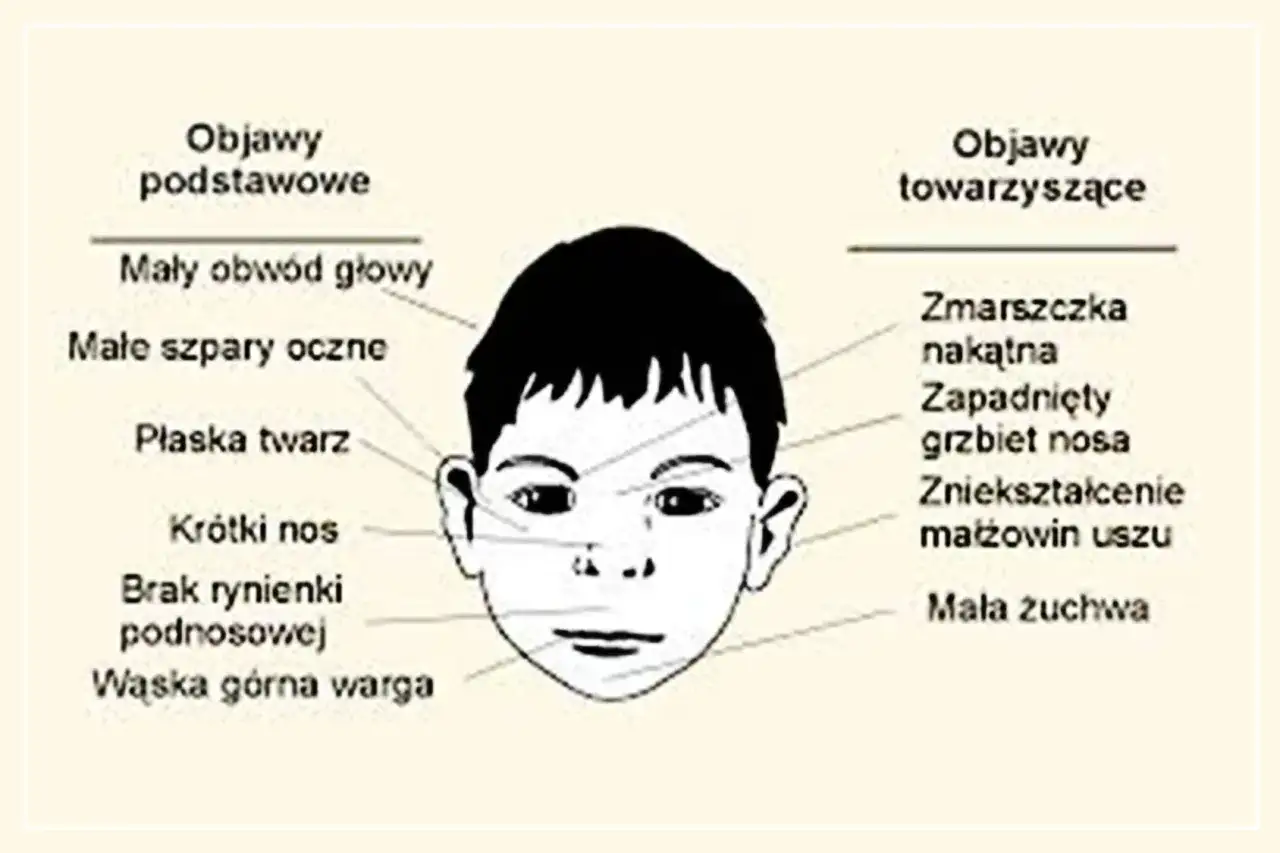 FAS i FASD - objawy, diagnoza, wsparcie. Co naprawdę pomaga?