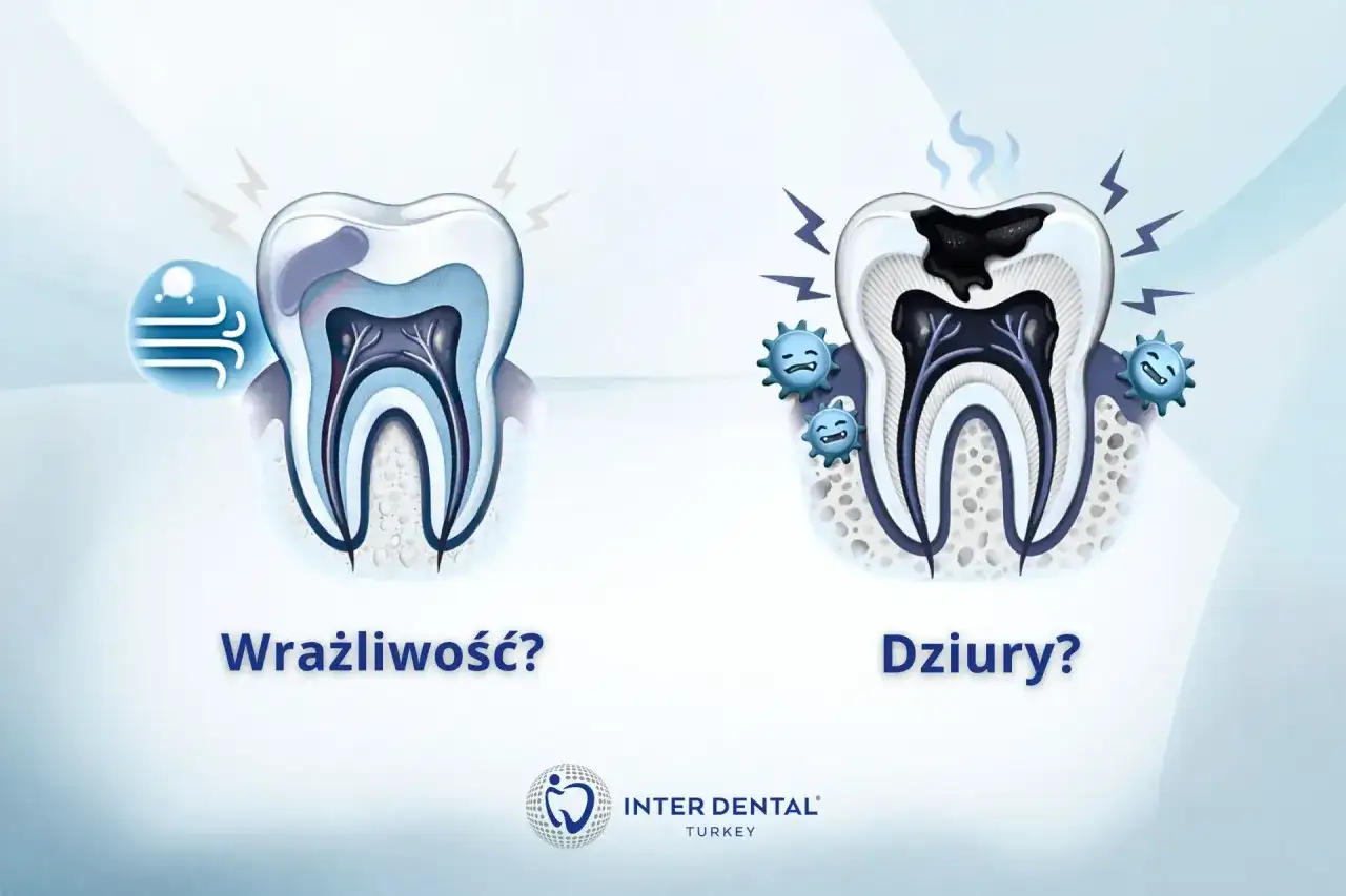 Ból zęba przy nagryzaniu - Przyczyny, leczenie, pilna wizyta
