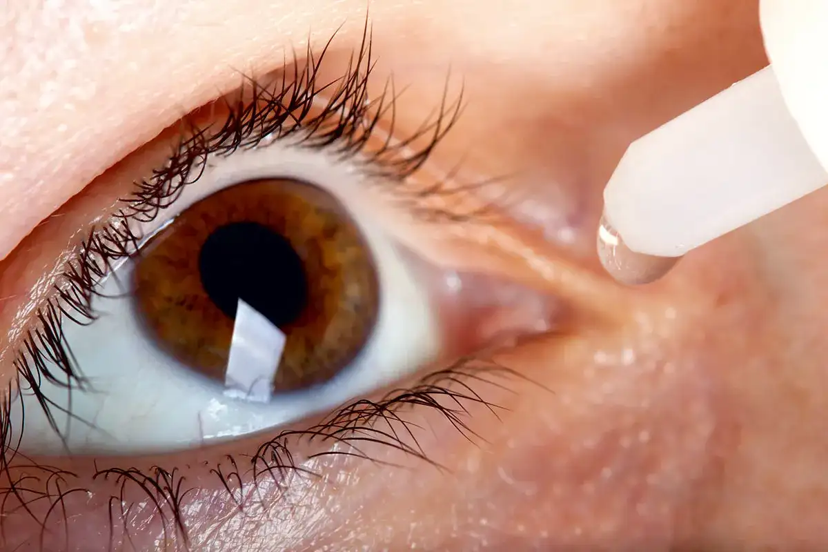 Monoprost - jak stosować krople na jaskrę bez błędów?