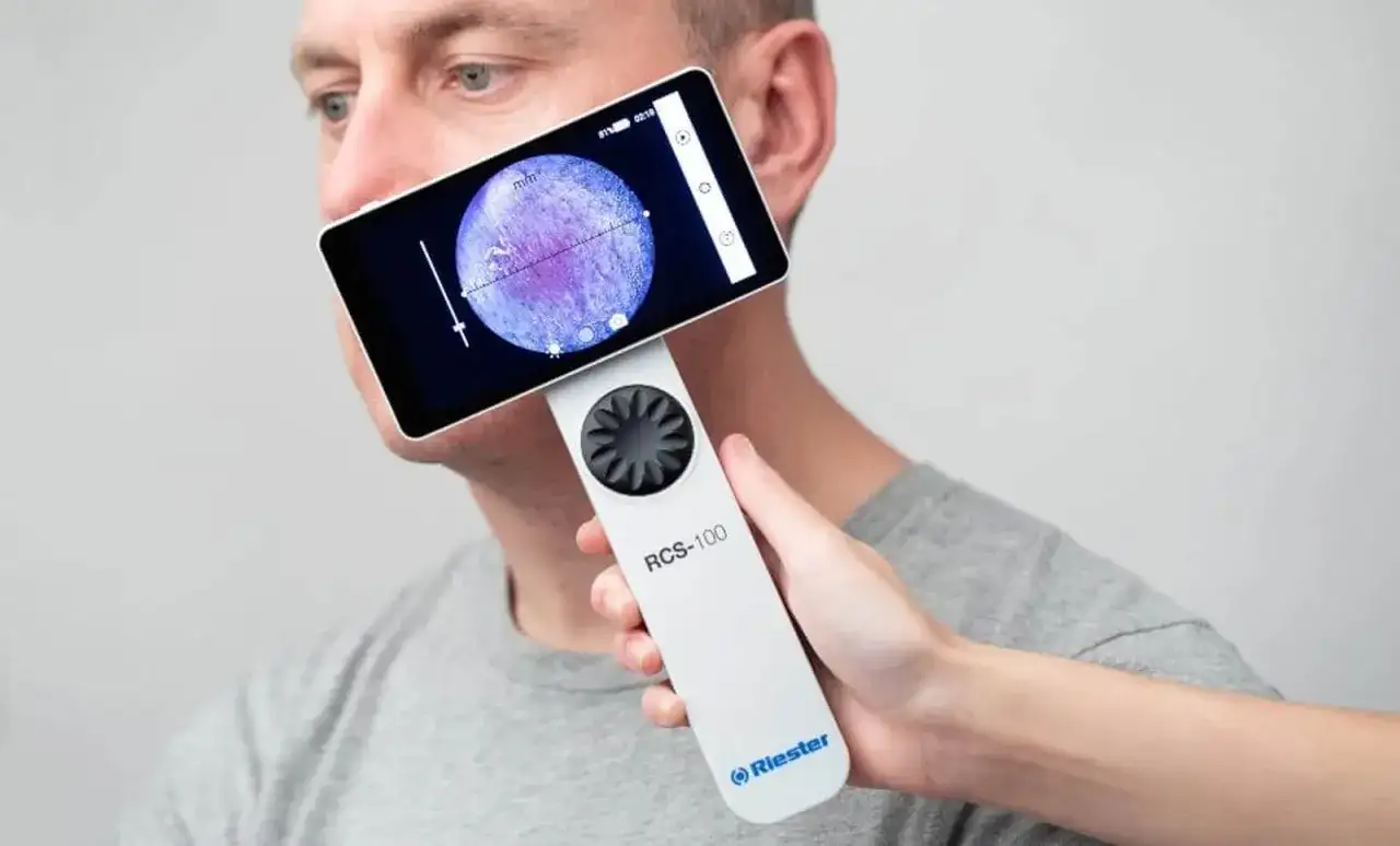 Wideodermatoskopia - Czy warto badać znamiona cyfrowo?