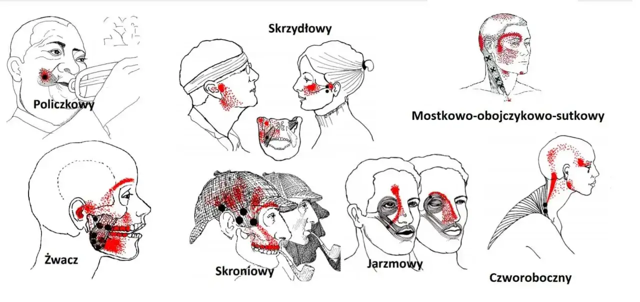 Uderzenie w szczękę - kiedy to stłuczenie, a kiedy złamanie?