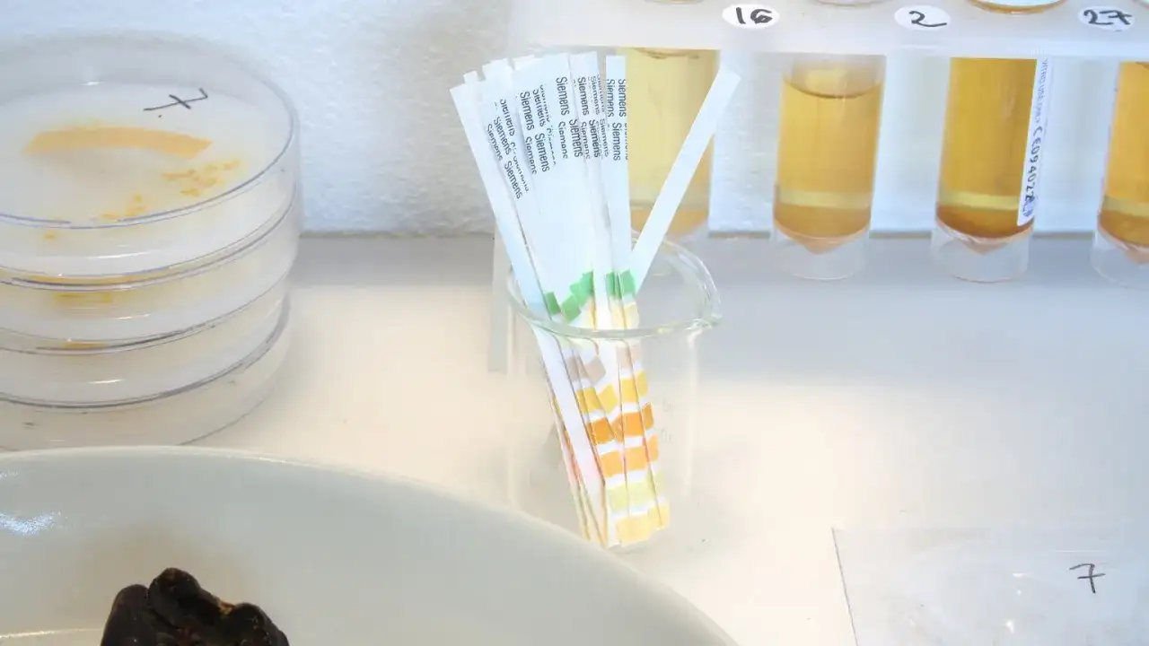 Azotyny w moczu - kiedy wynik naprawdę oznacza infekcję?