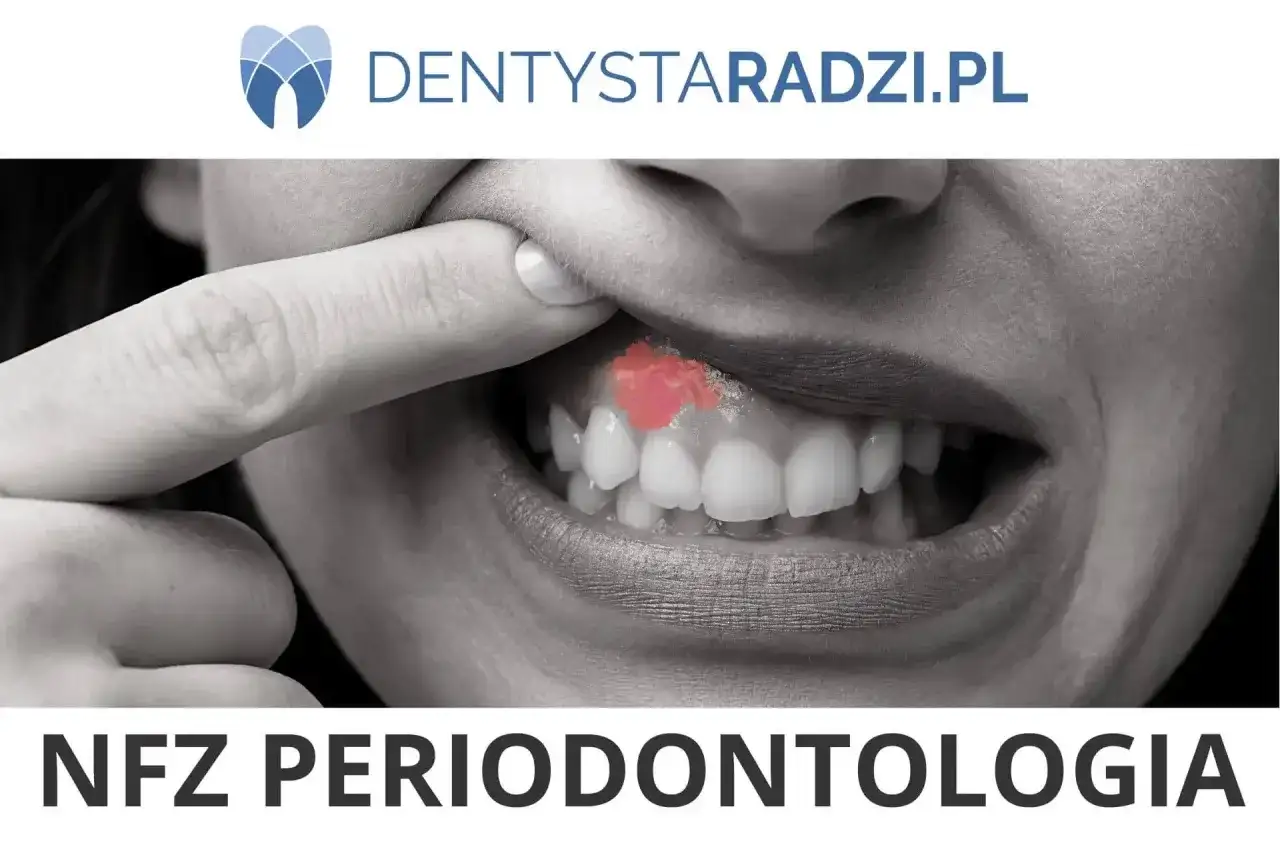 Parodontosis - Czym jest i jak leczyć? Co oferuje NFZ?
