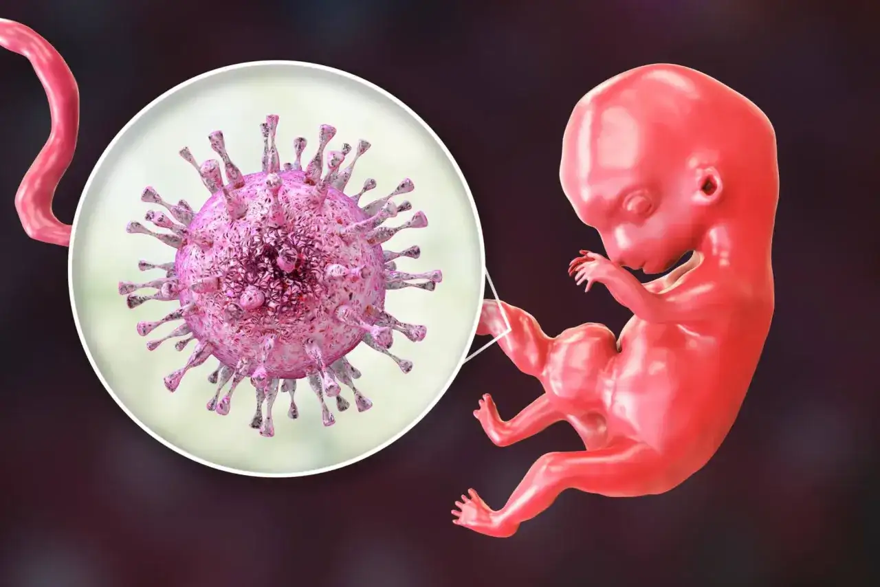 Cytomegalia w ciąży - co oznacza dodatni wynik i kiedy działać?