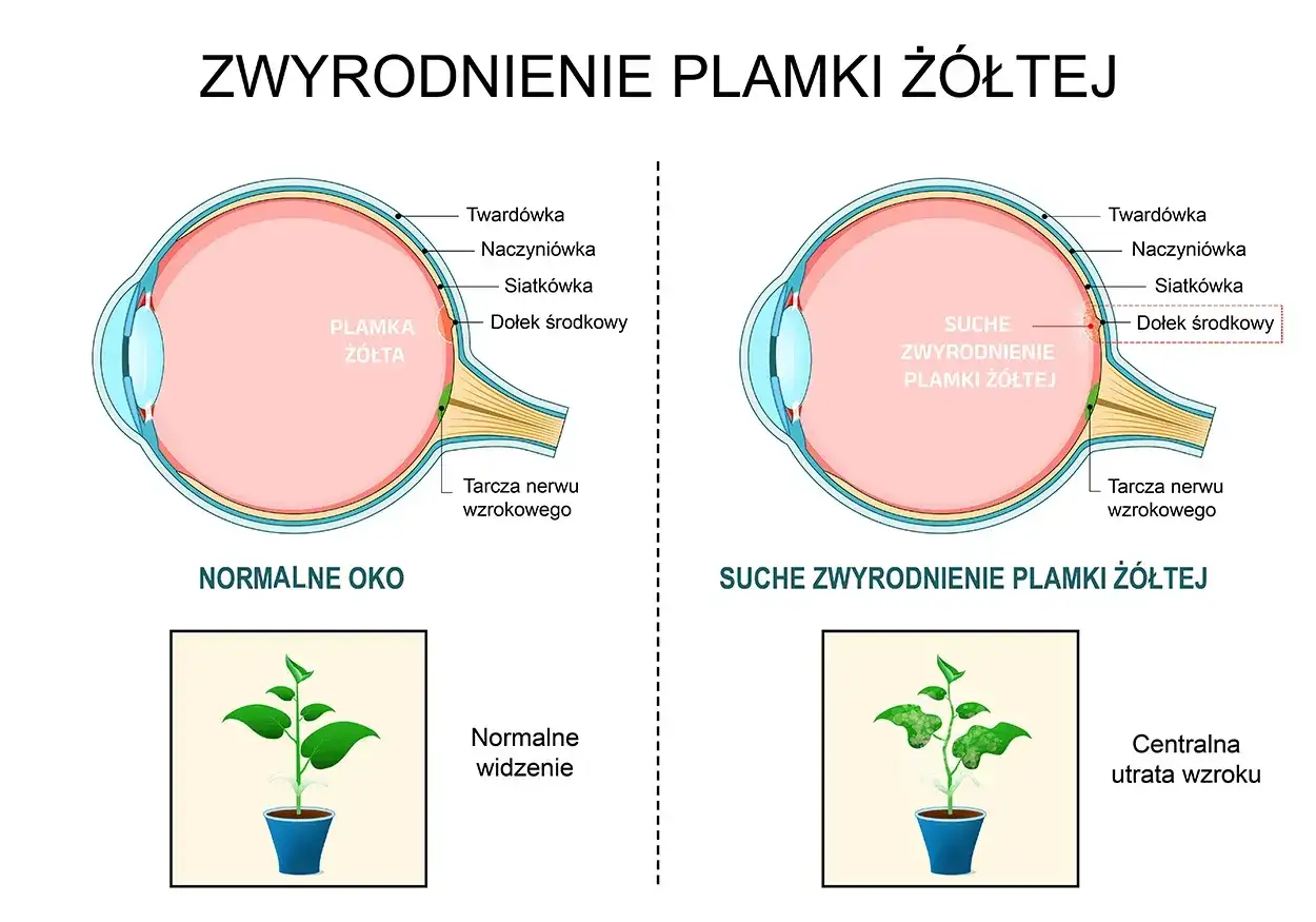 Falujące linie? Zniekształcony obraz - Co to znaczy?
