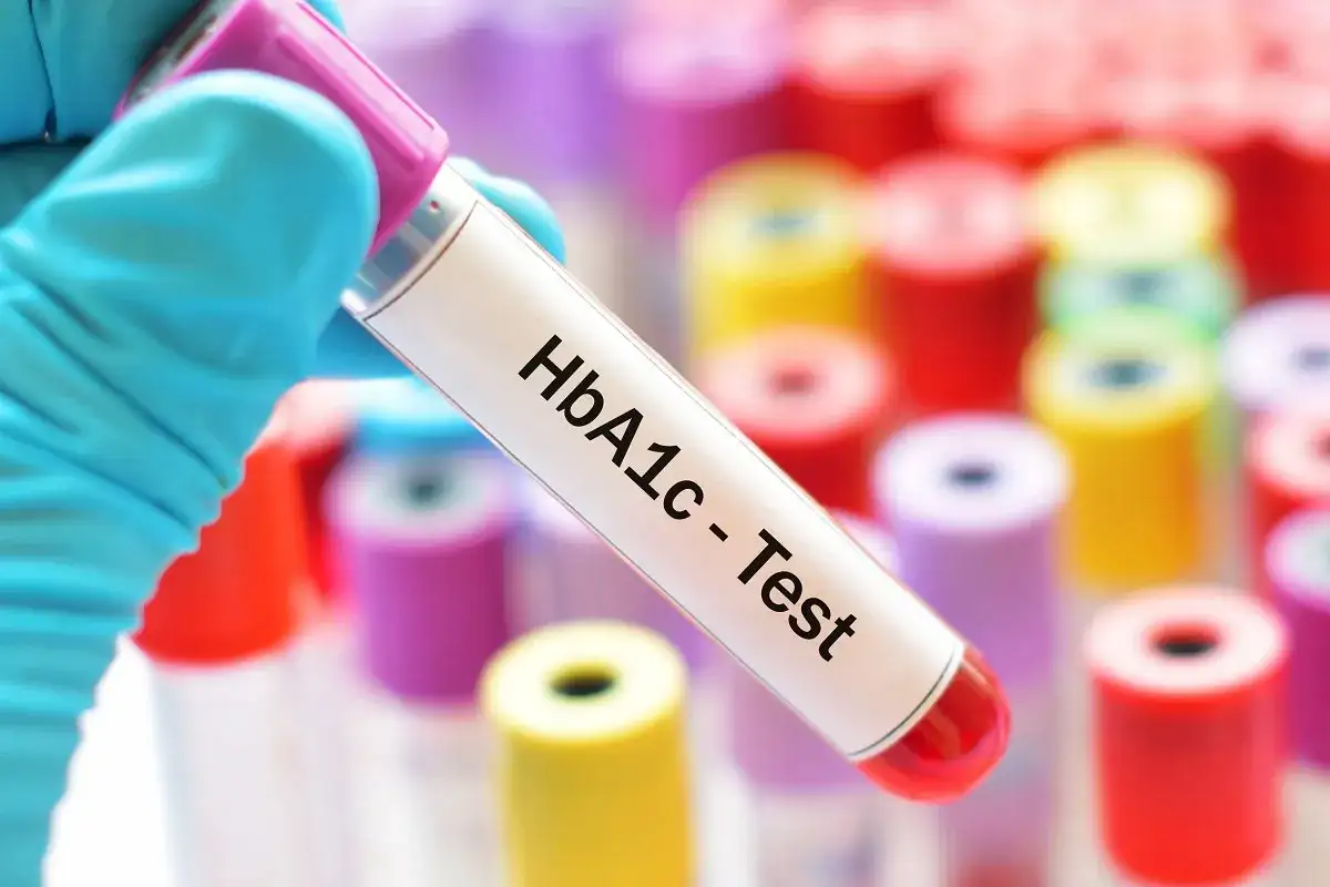 Hemoglobina glikowana (HbA1c) - cena, interpretacja, gdzie zrobić?
