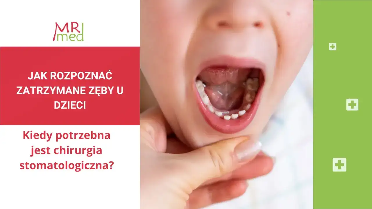 Opóźnione zęby stałe u dzieci - norma czy problem? Sprawdź