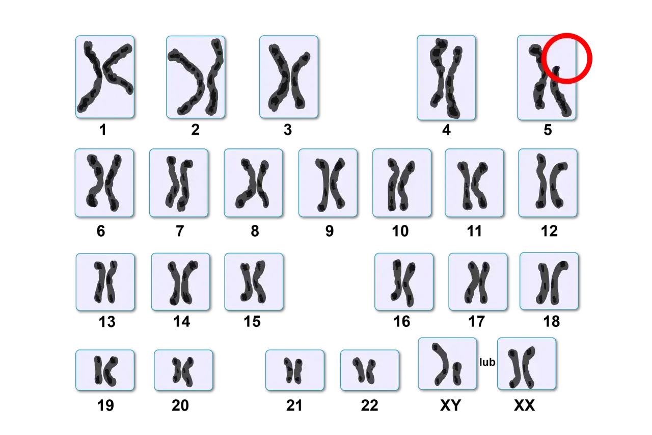 Ile chromosomów ma człowiek? 46, wyjątki i znaczenie kariotypu