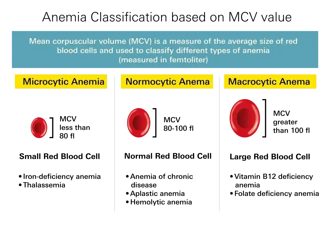 Anemia - jakie badania? Kompletny przewodnik po diagnostyce