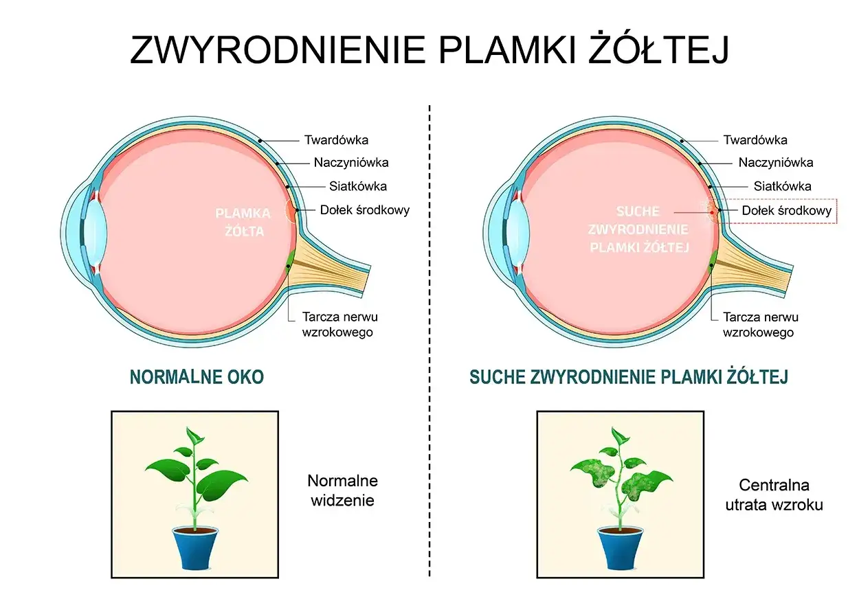 Falujące linie? Zniekształcony obraz - Co to znaczy?