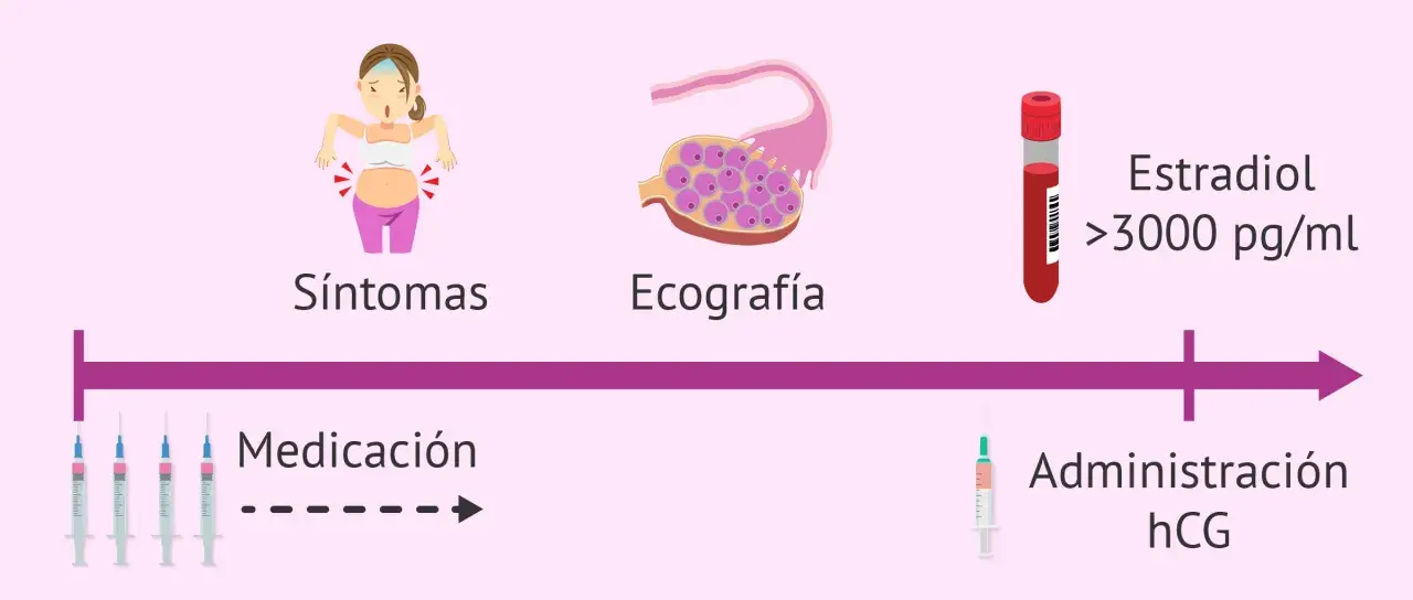 Proceso de donación de óvulos: síntomas, ecografía, medicación, estradiol alto y administración de hCG. A veces, duele donar óvulos.