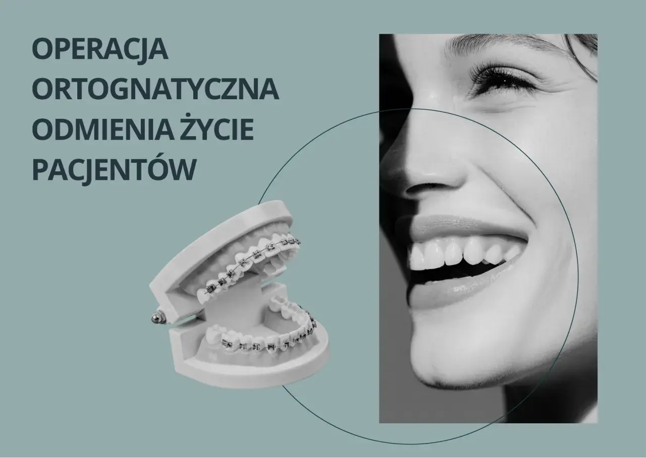 Model szczęki z aparatem ortodontycznym i uśmiechnięta twarz. Operacja ortognatyczna odmienia życie pacjentów.