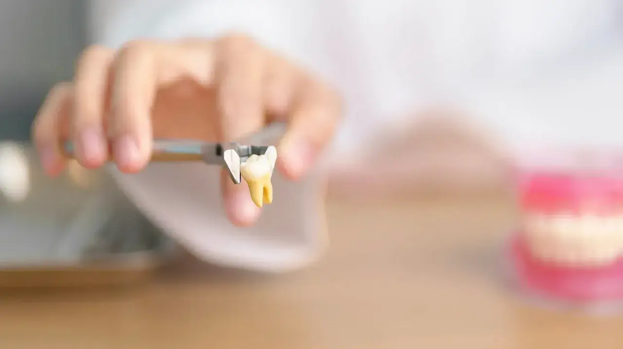 Un dente estratto con pinze, un monito per chi teme di rimanere senza denti a 40 anni.