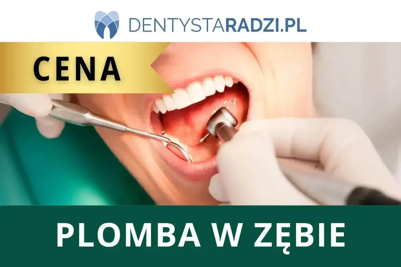 Cena plomby u dentysty? Zobacz, ile kosztuje leczenie zęba i jakie są dostępne opcje.