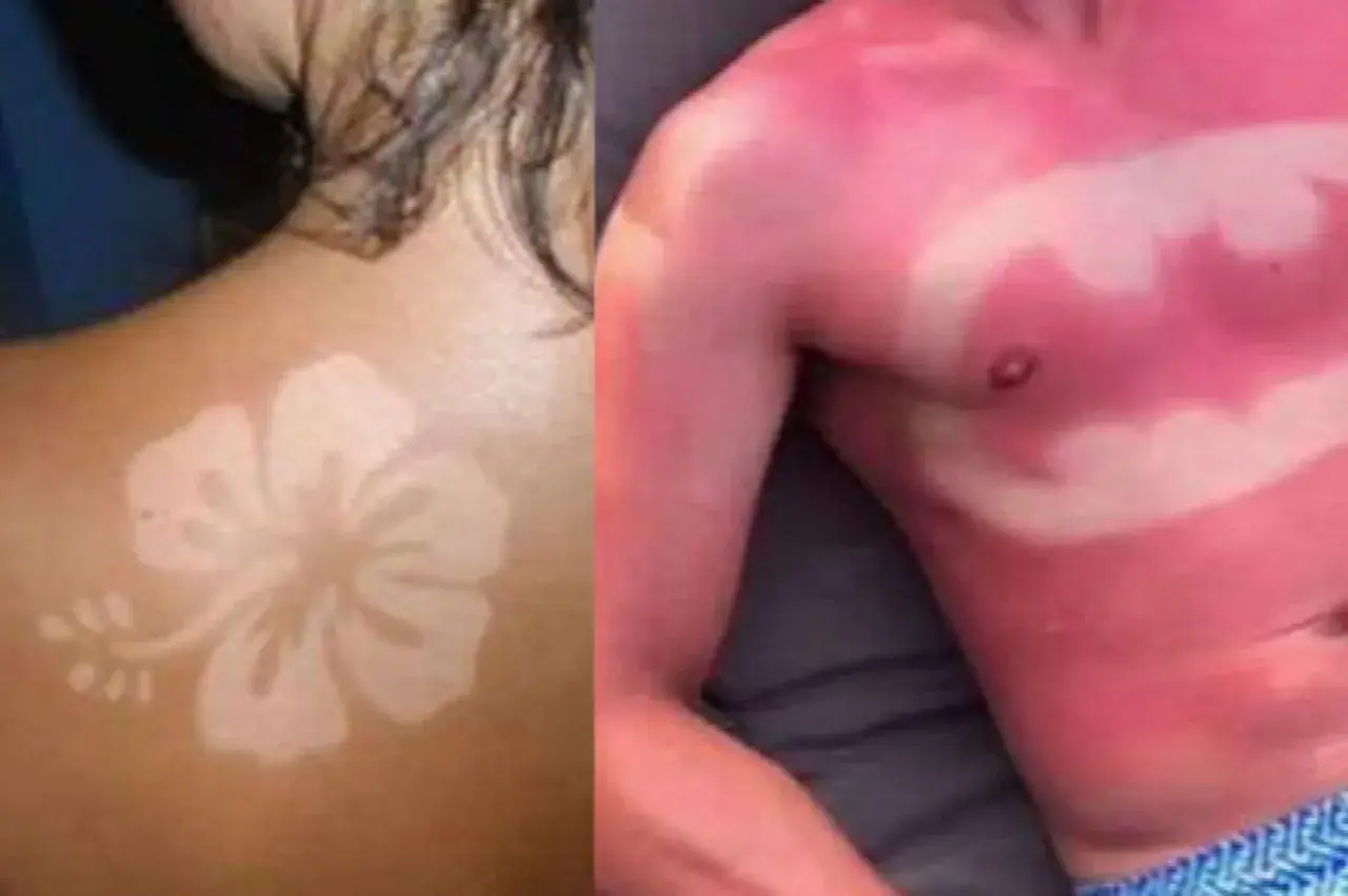 Un coup de soleil révèle un tatouage en forme de fleur d'hibiscus sur une épaule. Sur la droite, un autre coup de soleil dessine le symbole de Batman sur un torse.
