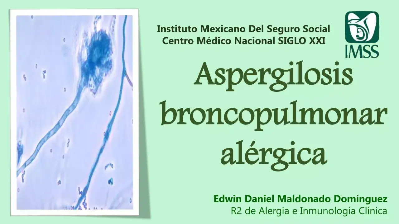 Microscopía de Aspergillus fumigatus, causante de aspergilosis broncopulmonar alérgica.