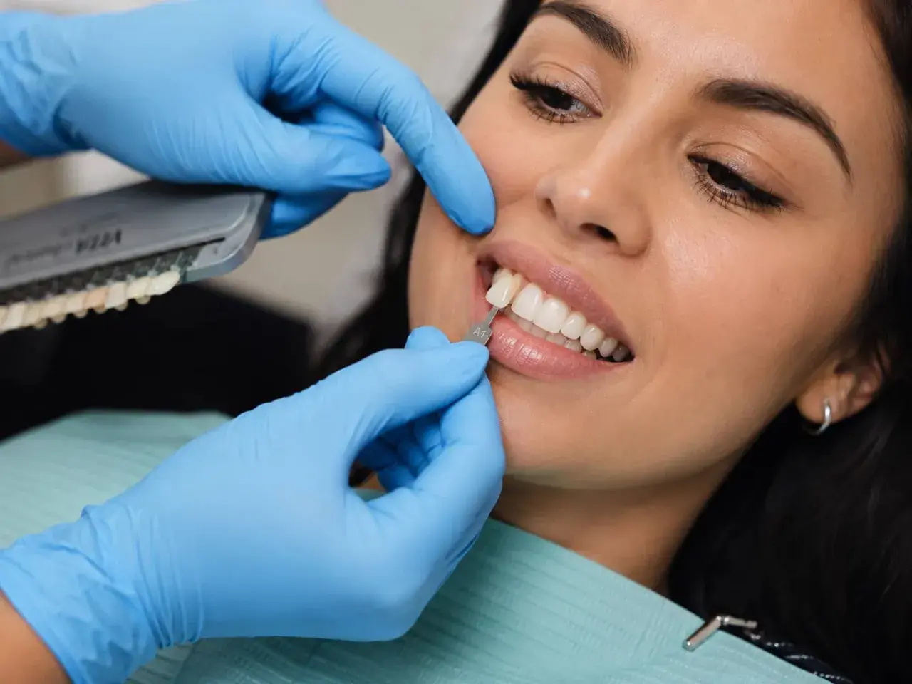 Dobór idealnego odcienia żywicy kompozytowej na zęby. Dentysta porównuje kolor zęba z wzornikiem.