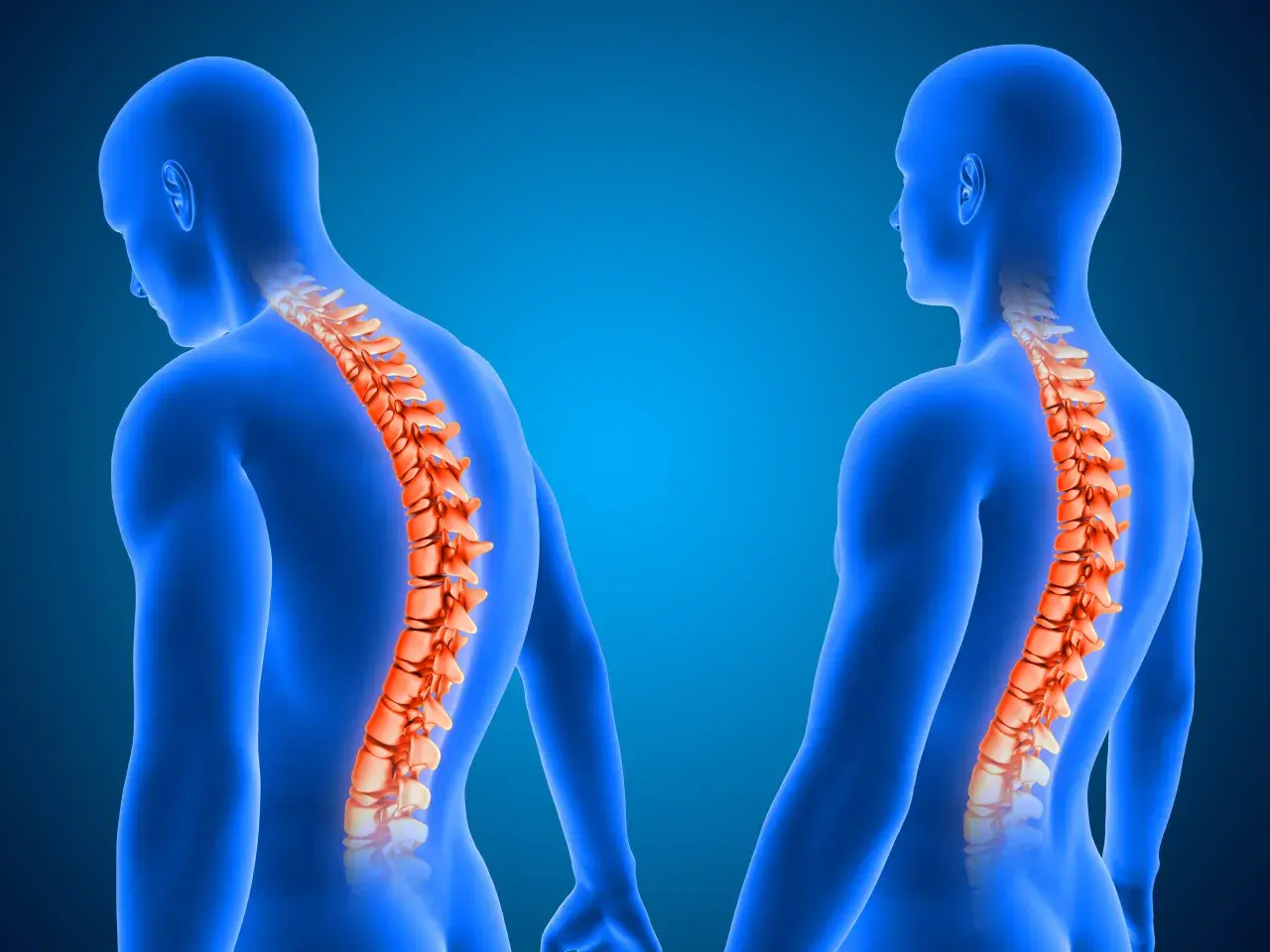 Dos figuras humanas azules muestran la columna vertebral en naranja.