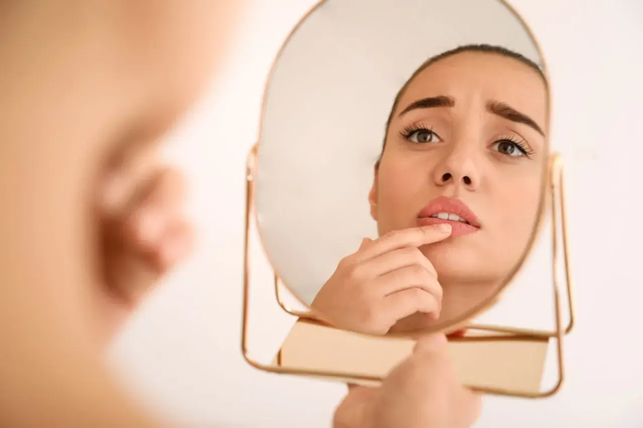 Ragazza preoccupata si guarda allo specchio, toccandosi le labbra screpolate, segno di afte da stress.