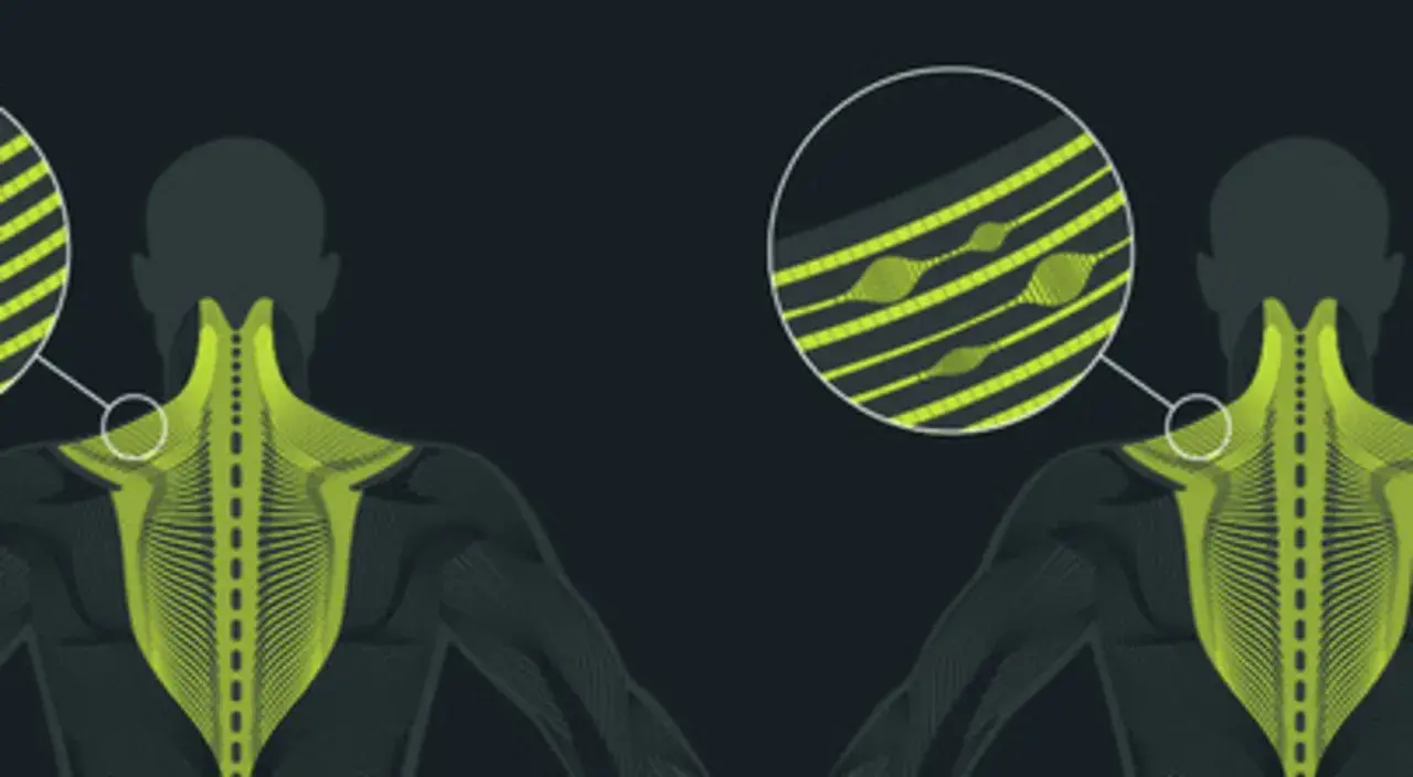 Illustration anatomique montrant des points de tension musculaire, avec un zoom sur des fibres tendues. La traduction de "trigger point" est ici illustrée.