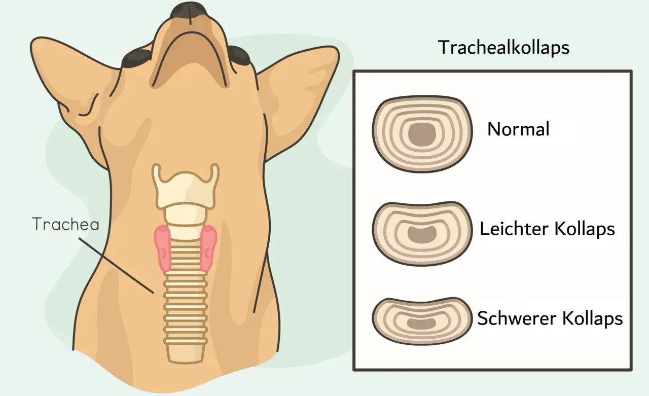 Illustration zeigt einen Hundehals mit der Luftröhre und Vergleiche von normaler, leichter und schwerer Trachealkollaps bei Hunden.