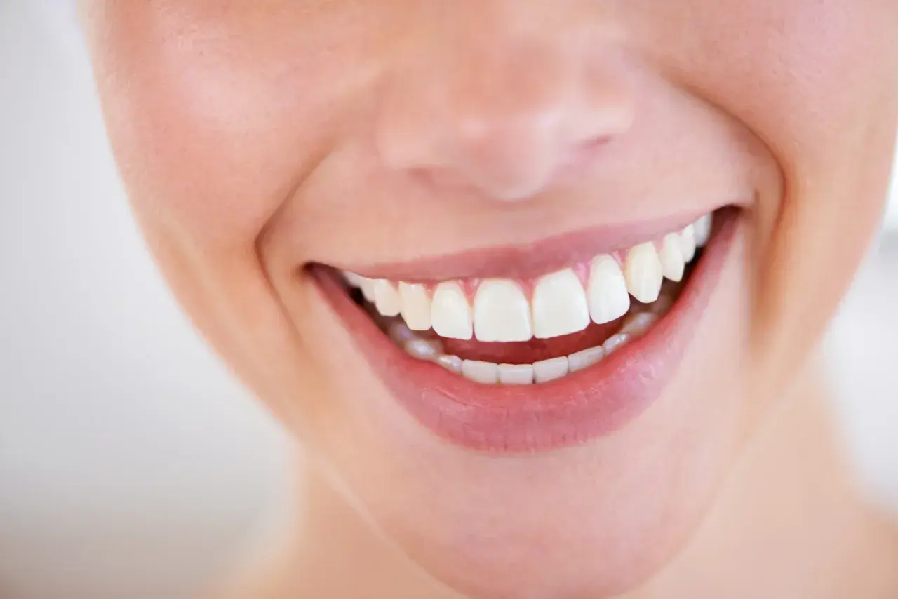 Sorriso smagliante con denti bianchi e perfetti, un vero spettacolo **male al dente** non è un problema qui.