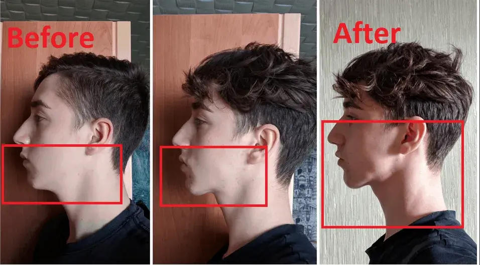 Jak ćwiczyć prawidłową pozycję spoczynkową języka dla zdrowia