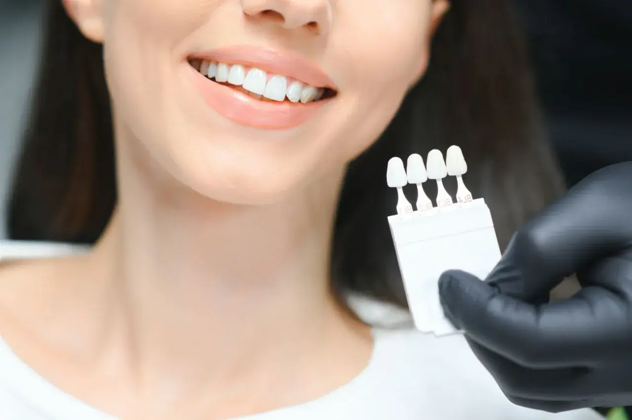 Uśmiechnięta kobieta z białymi zębami, dentysta porównuje odcień zębów z wzornikiem przed wybielaniem.