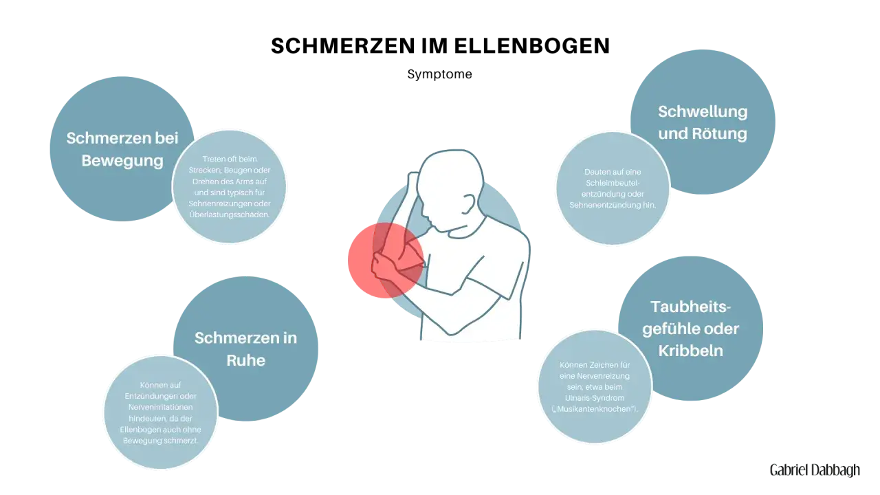 Schmerzen im Ellenbogen: Symptome wie Schwellung, Rötung, Schmerzen bei Bewegung oder in Ruhe, Taubheitsgefühle oder Kribbeln können auf Entzündungen oder Nervenreizungen hindeuten.