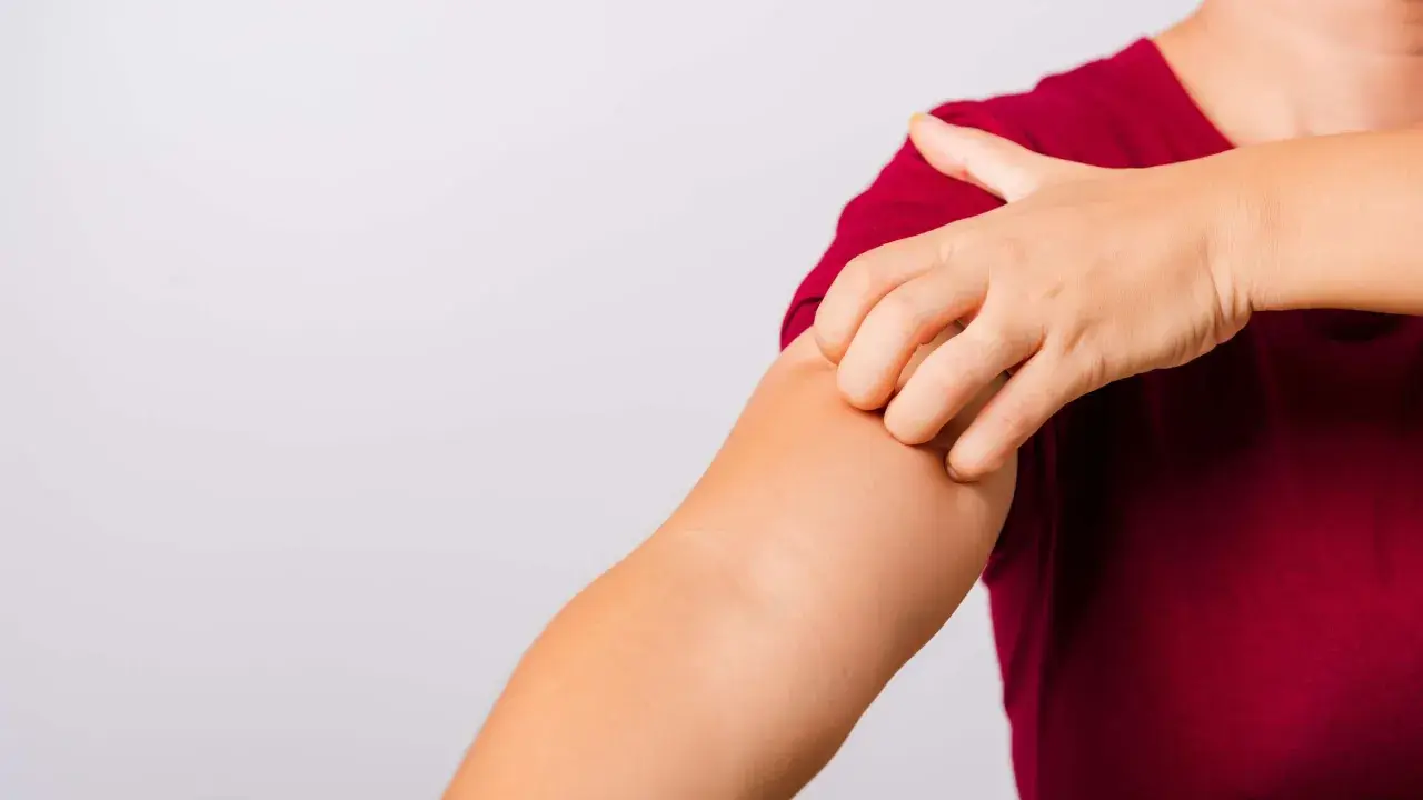 Eine Hand kratzt sich am Arm. Vielleicht hilft **Essig gegen Juckreiz**?