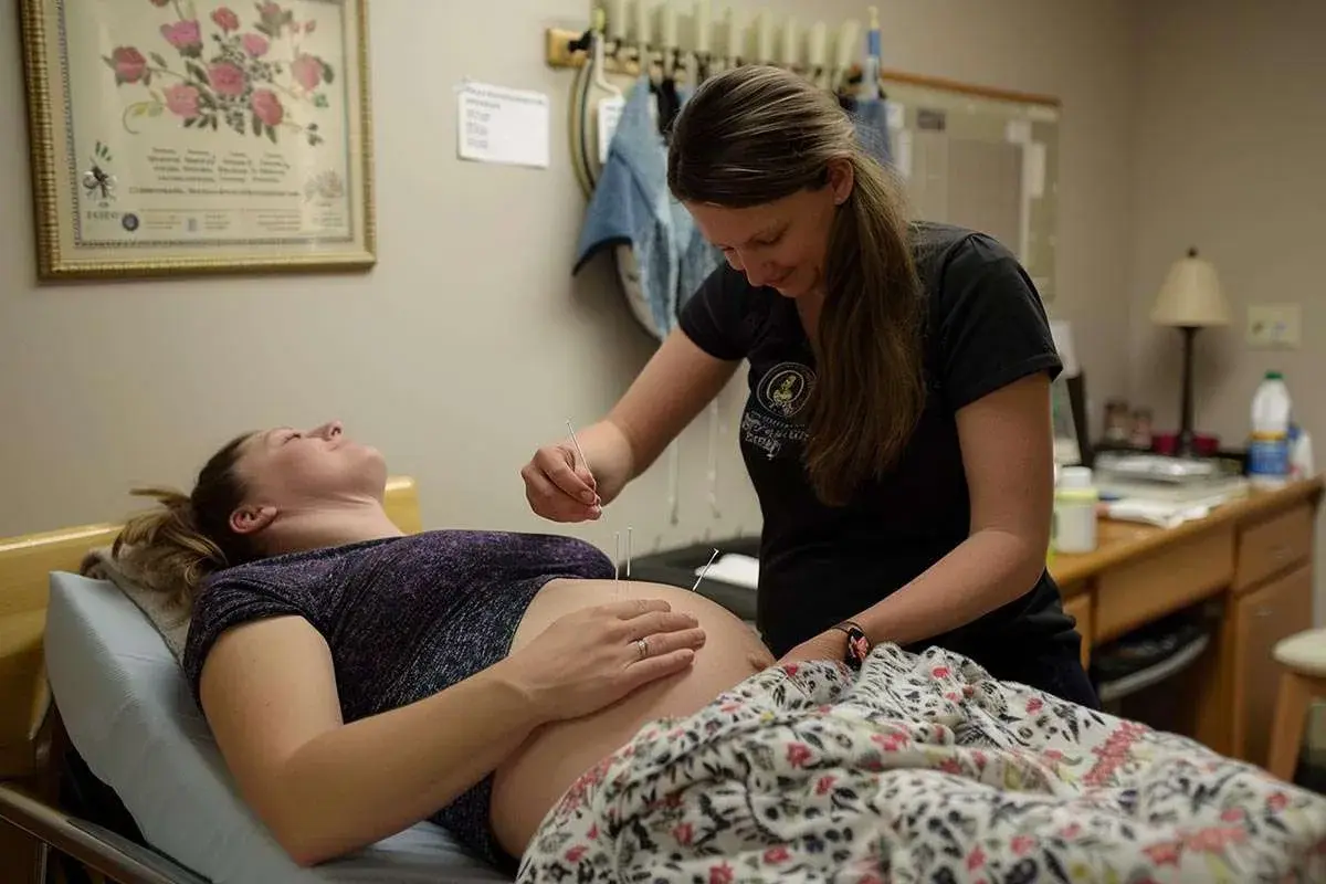 Une praticienne applique des aiguilles d'acupuncture sur le ventre d'une femme enceinte, une approche douce pour l'accouchement.